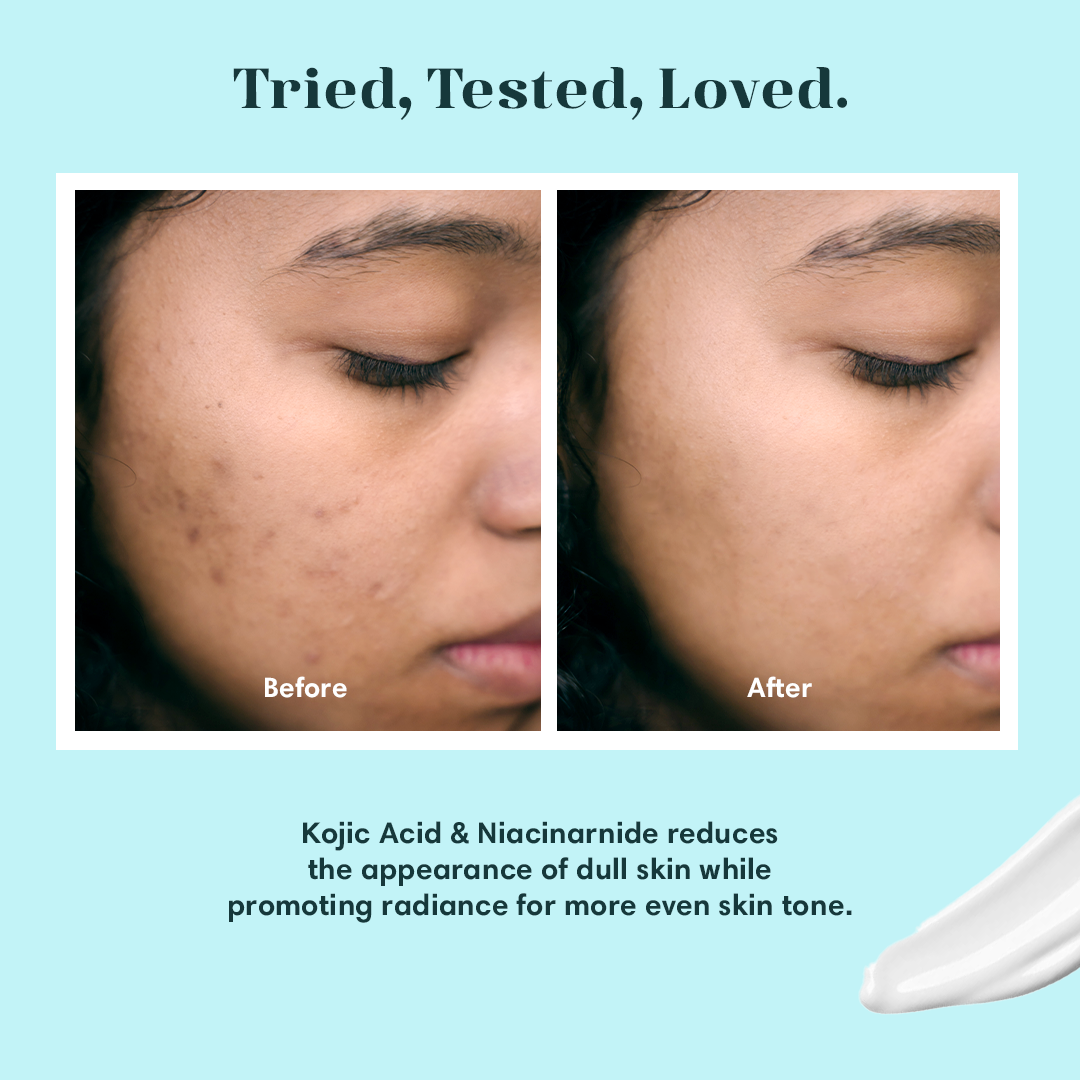 Kojic Acid Cream (Buy 1 Get 1 Free)