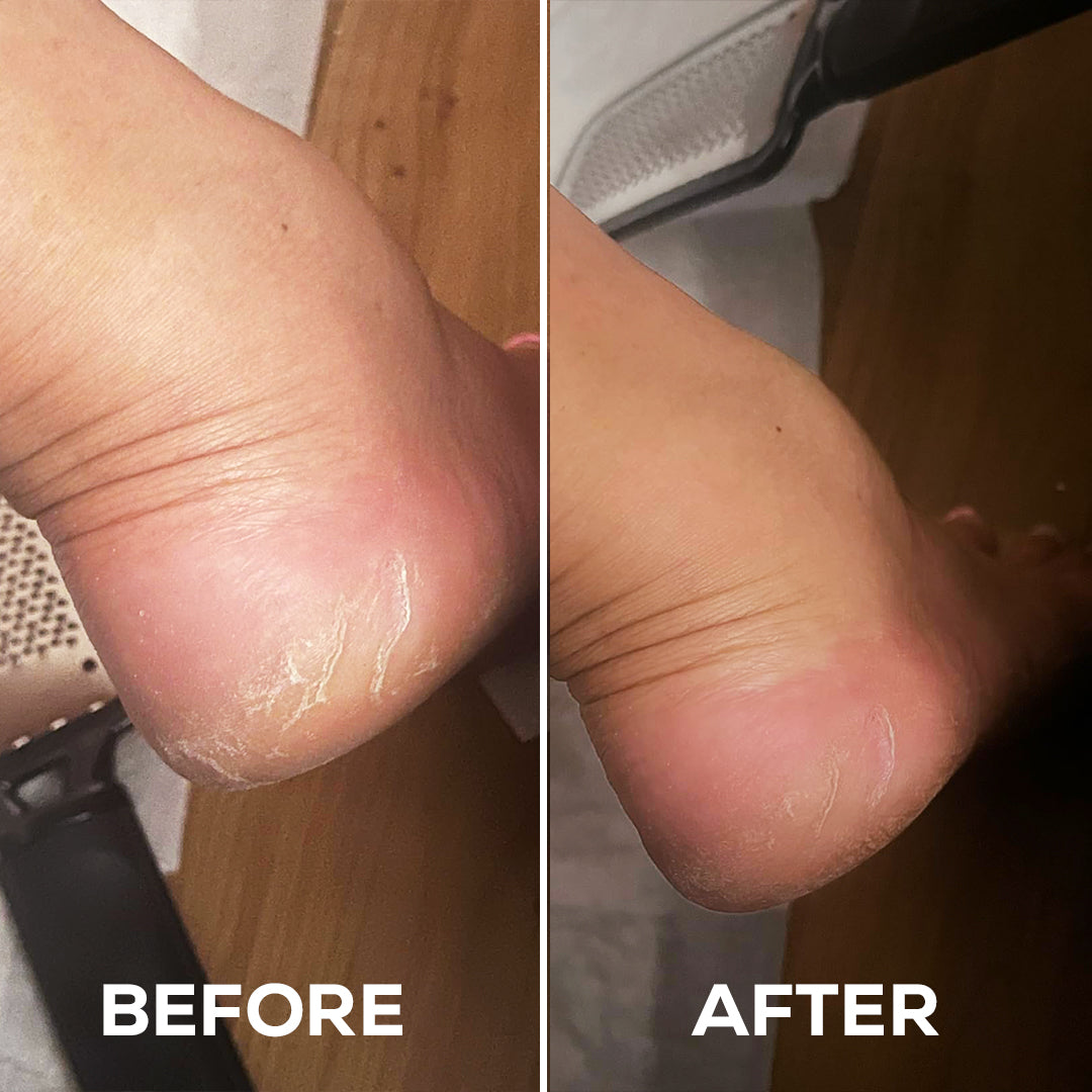 Moisturizing Foot Mask (Buy 1 Get 1 Free)
