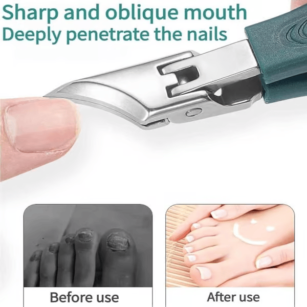 3-Piece Nail Clipper Set (With Filer)