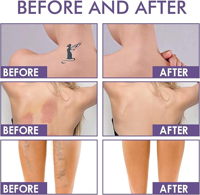 Body Coverage Perfector + (Free Applicator)