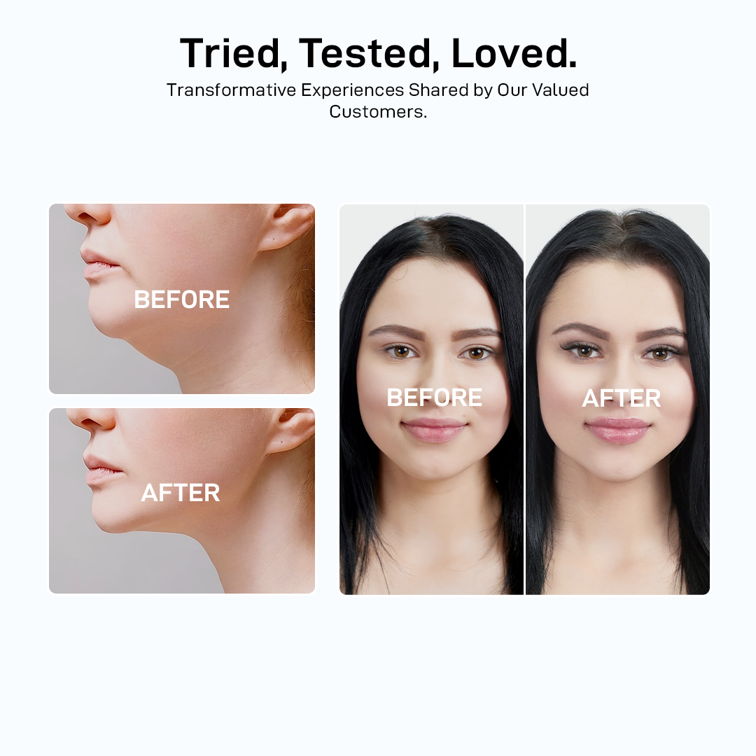 Invisible Face Lifter Tape (40Pcs)