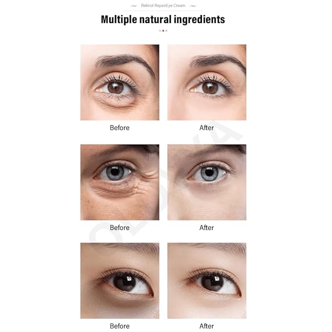 The Vita-A  Retinal Shot Tightening Booster