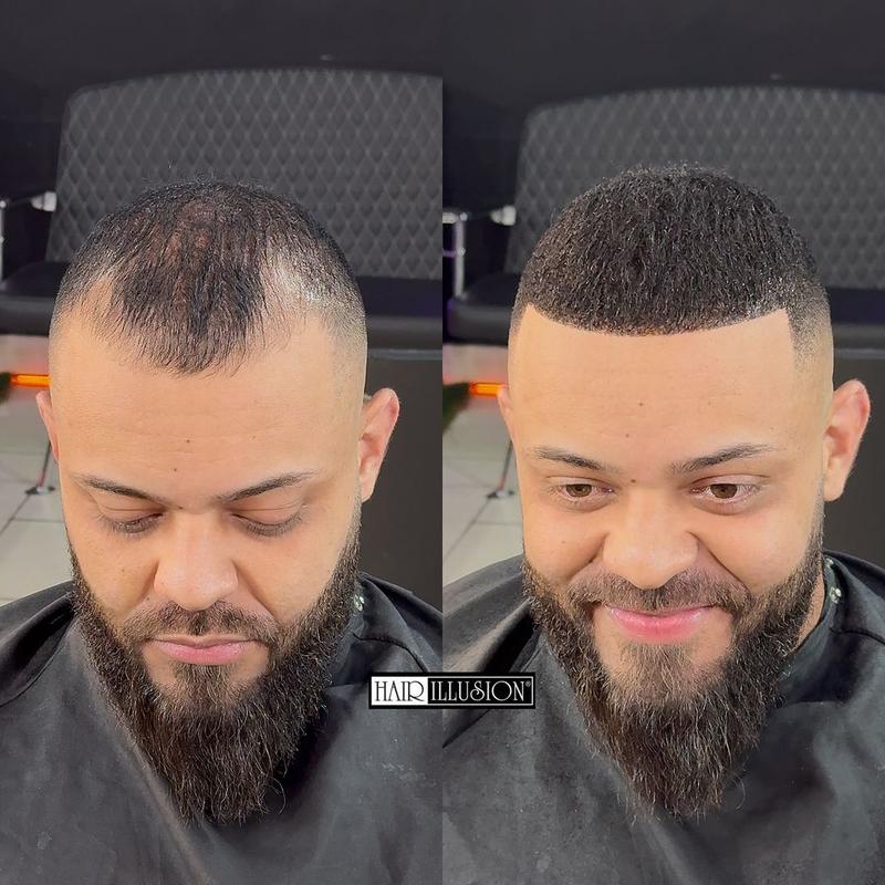 Hair Fibers Combo Kit