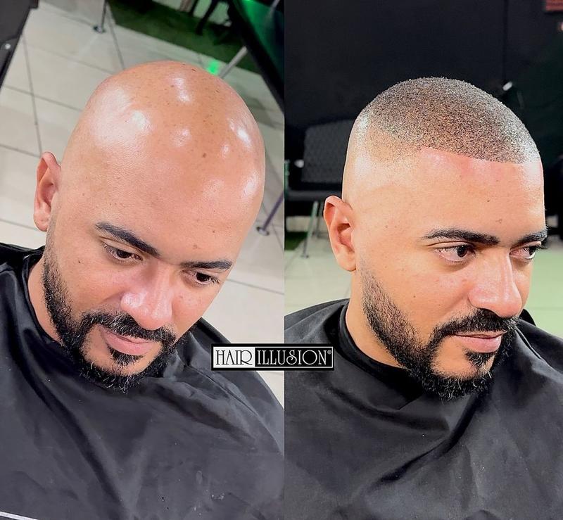 Hair Fibers Combo Kit