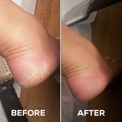 Moisturizing Foot Mask (Buy 1 Get 1 Free)