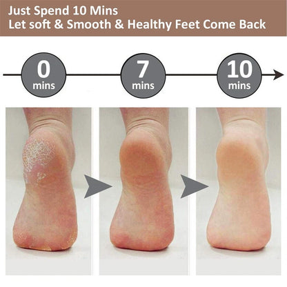 Electric Foot Callus Remover- Professional Foot Cleaner for Dead Skin